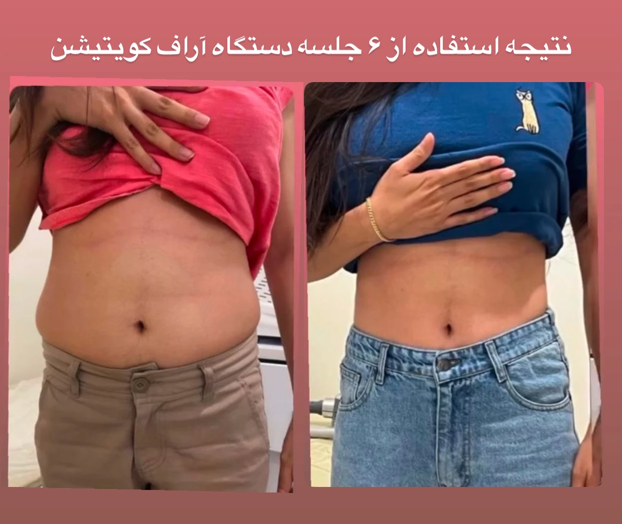 کلینیک زیبایی، لیزر و تغذیه دکتر حسنلو