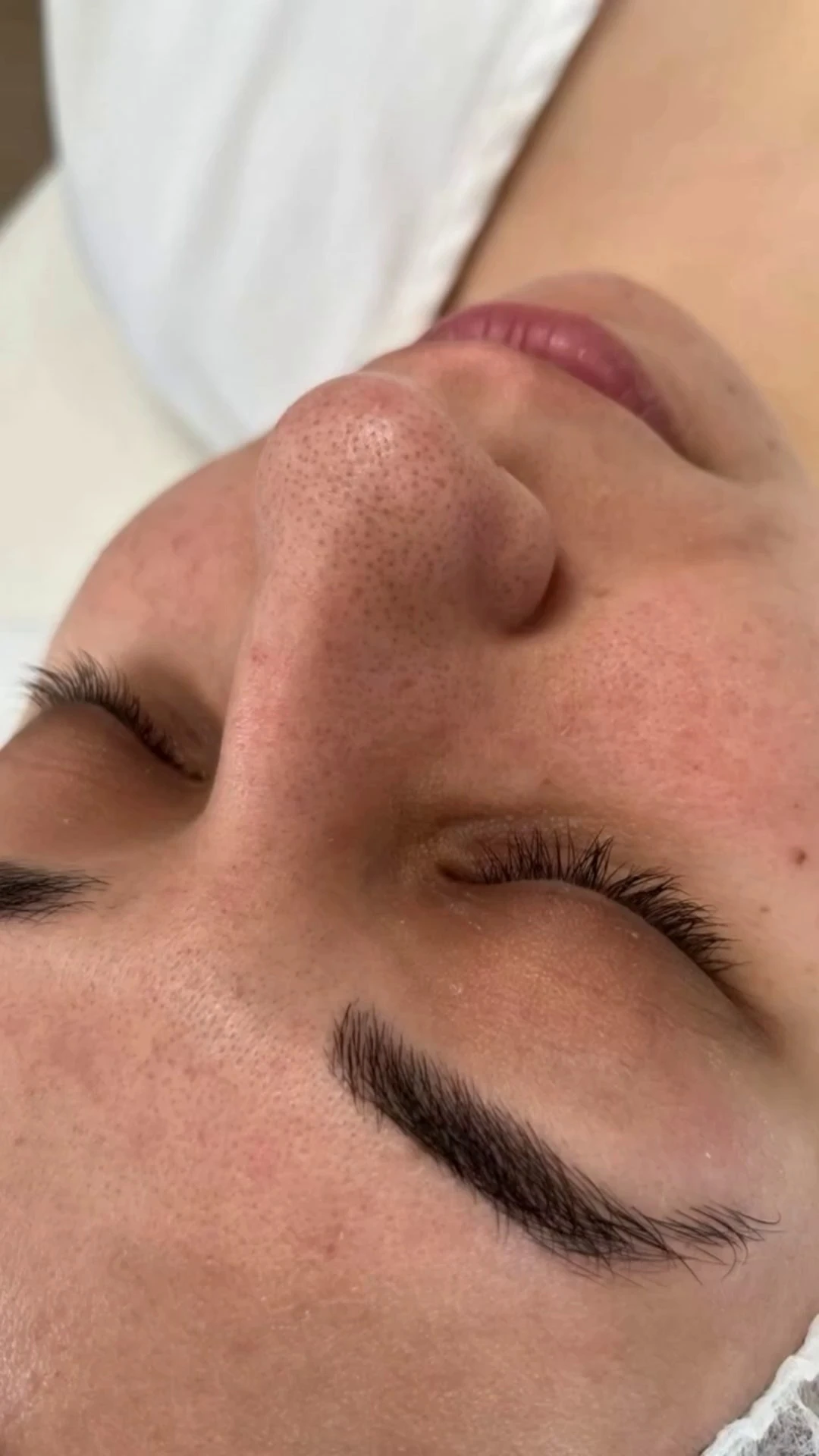 فیشال و پاکسازی پوست تخصصی بانوان نیلا