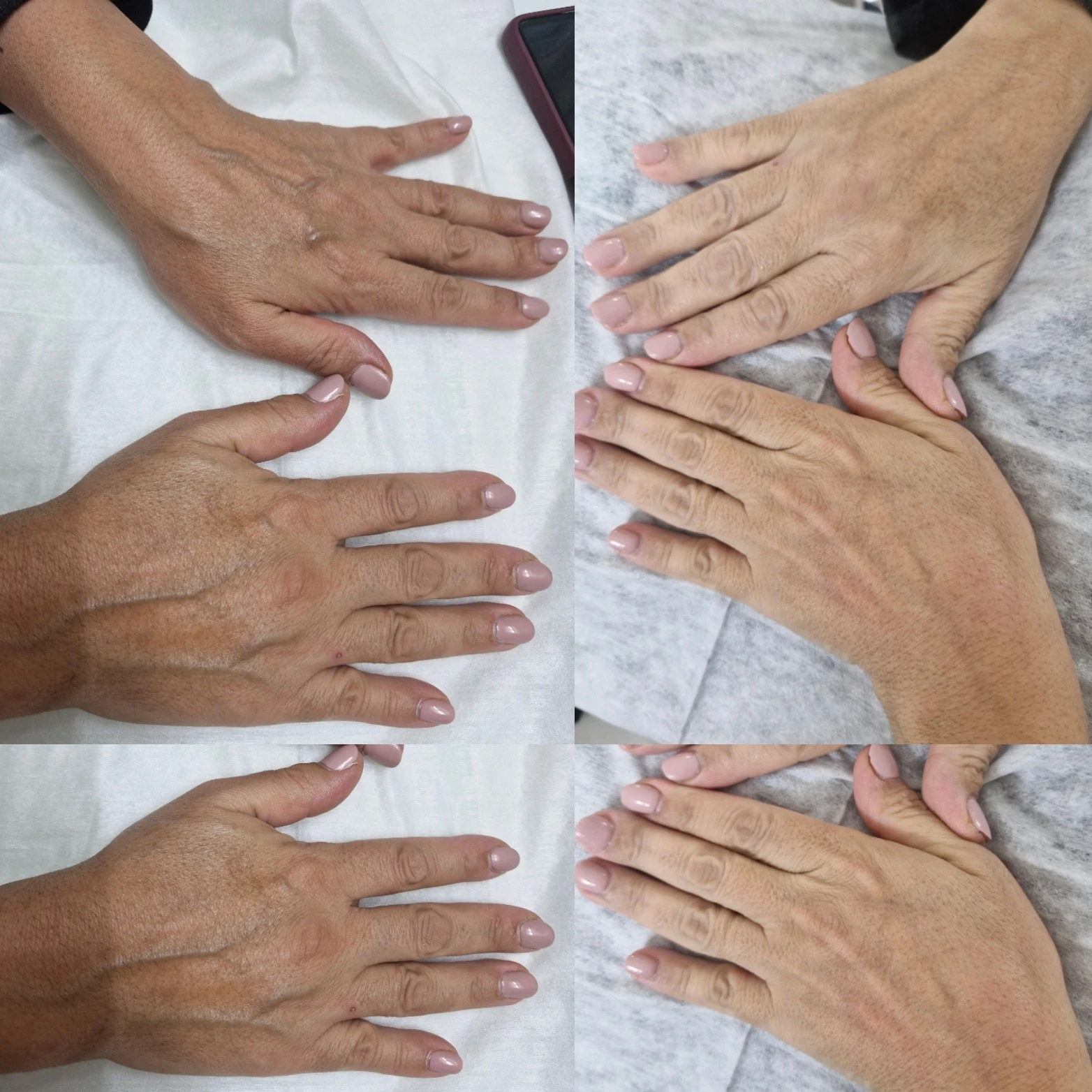 خدمات تخصصی پاکسازی پوست رویال اسکین
