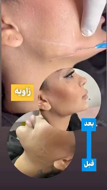 کلینیک زیبایی رایکا