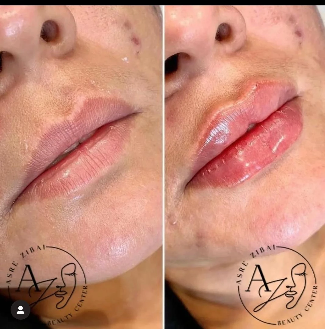 کلینیک پوست مو لیزر و لاغری عصر زیبایی