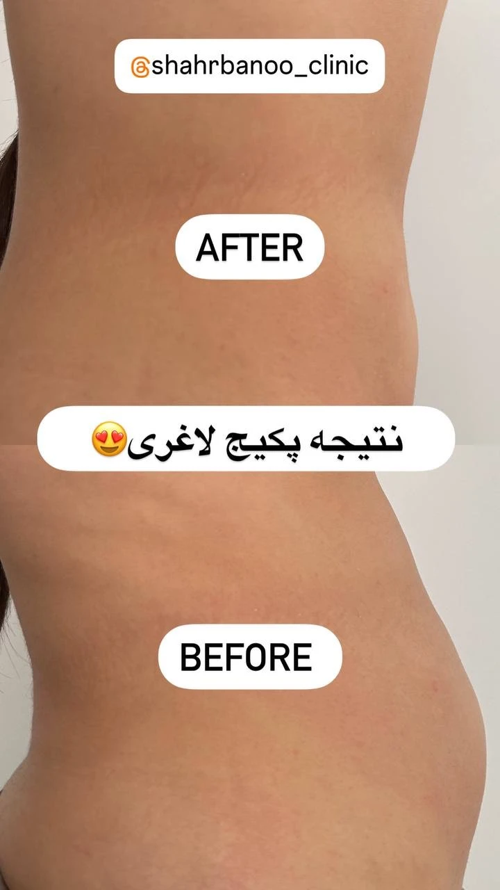 کلینیک پوست مو زیبایی شهربانو
