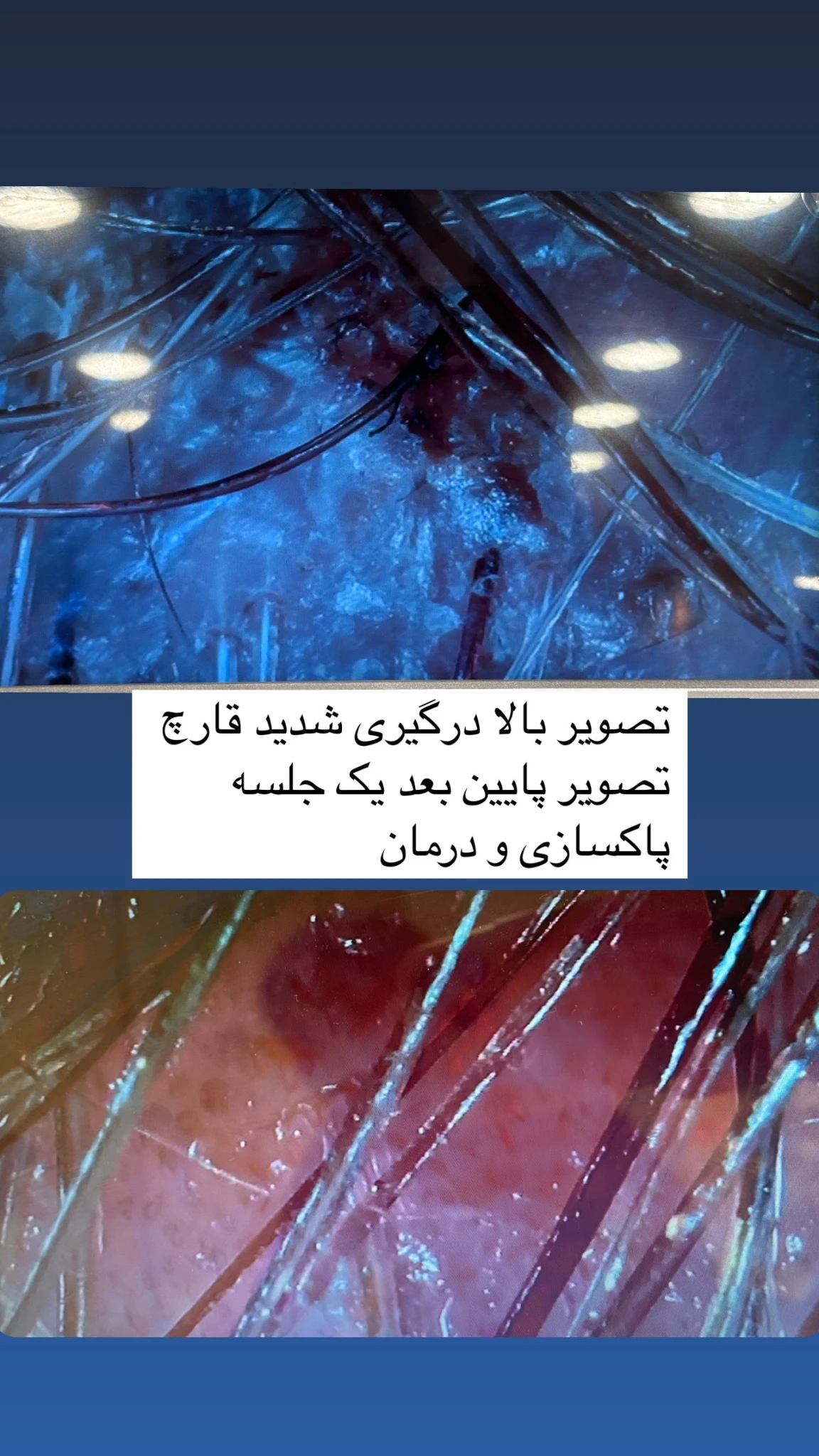کلینیک پاکسازی و فیشیال پوست سالاری