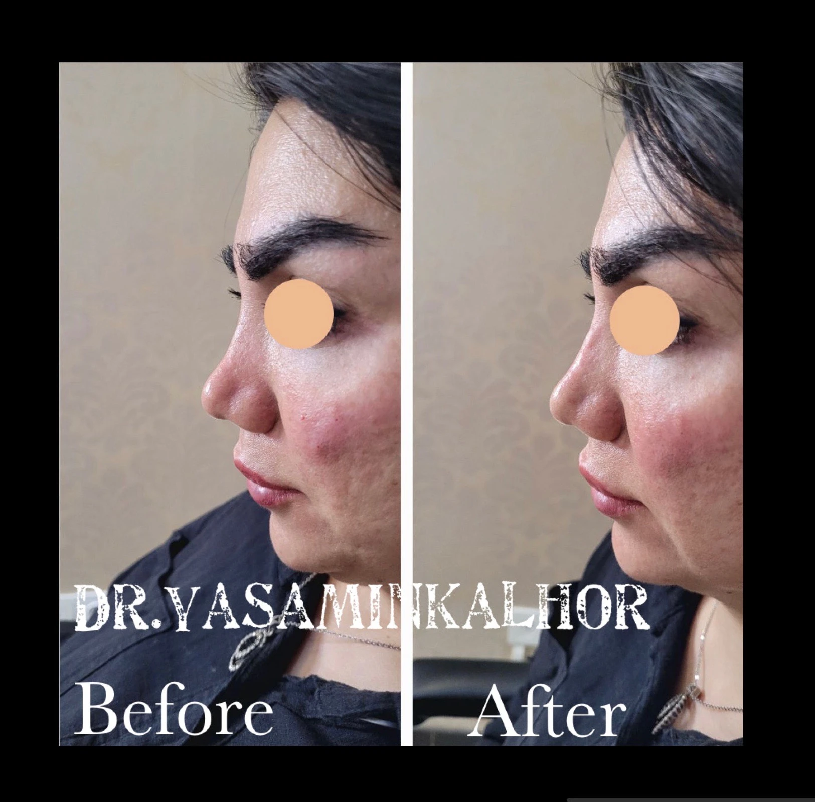 مرکز لیزر کلینیک زیبایی و بوتاکس یاسمینا