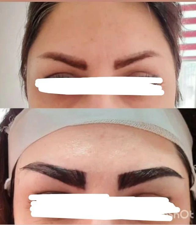 مرکز تزریق چربی و لیزر بدن شمس آباد