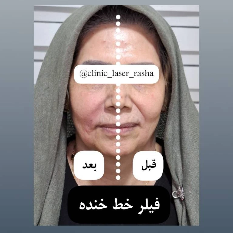 کلینیک لیزر و زیبایی راشا