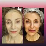  کلینیک زیبایی و لاغری یسنا