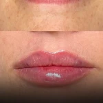 مطب پوست، مو،زیبایی و لیزر دکتر ستارپور