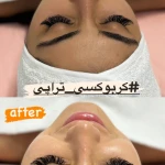  کلینیک پوست، لیزر و زیبایی رایکا
