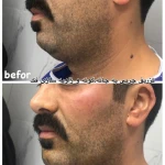  مرکز پوست و زیبایی دکتر شهلا وزیری نسب
