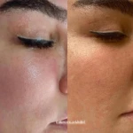 فیشیال و پاکسازی پوست رخشید