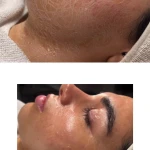  مرکزتخصصی فیشال وپاکسازی پوست آزیتا نوری