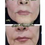  کلینیک زیبایی مرکز لیزر دکترپروانه نوری