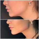  کلینیک لیزر و زیبایی بیوتا
