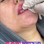  کلینیک زیبایی و لیزر کامالیزر