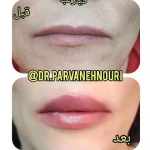  کلینیک زیبایی مرکز لیزر دکترپروانه نوری