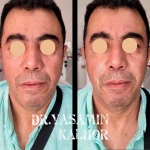  مرکز لیزر کلینیک زیبایی و بوتاکس یاسمینا