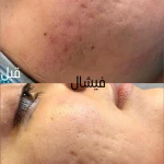  مرکز لیزر،پوست،مو و زیبایی سرو مهر