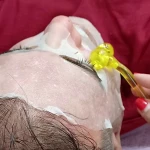  کلینیک زیبایی و لیزر موهای زائد ابریشم