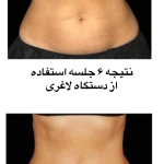  کلینیک زیبایی، لیزر و تغذیه دکتر حسنلو