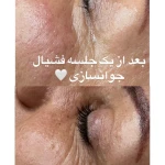  فیشال و پاکسازی تخصصی حنانه وقاری