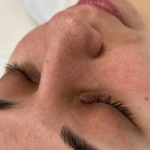 فیشال و پاکسازی پوست تخصصی بانوان نیلا