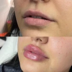 کلینیک زیبایی ملو بیوتی(تخفیف ویژه)