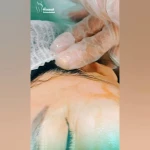  کلینیک تخصصی پوست مو زیبایی و لیزر هانا