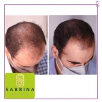  کلینیک پوست، زیبایی و لیزر سابرینا