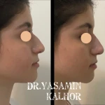  مرکز لیزر کلینیک زیبایی و بوتاکس یاسمینا
