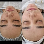  خدمات تخصصی پاکسازی پوست رویال اسکین