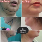  کلینیک تخصصی پوست مو زیبایی و لیزر هانا