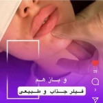  کلینیک زیبایی و پوست و مو ماه میس