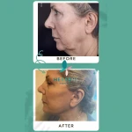  کلینیک فوق تخصصی پوست مو زیبایی و لاغری هسنس