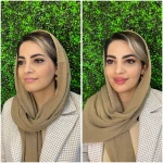  کلینیک زیبایی لاغری لیزر زیبابمون