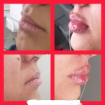 مرکز تزریق چربی و لیزر بدن شمس آباد