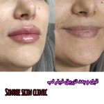 مرکز لیزر و کلینیک زیبایی سینوهه