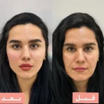  کلینیک زیبایی زارا