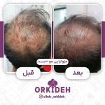  کلینیک زیبایی و بوتاکس ارکیده
