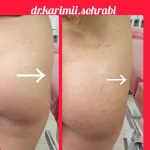 مرکز تزریق چربی و لیزر بدن شمس آباد