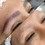  مرکز فیبروز، میکروبلیدینگ و آرایش دائم عاطفه