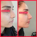  مرکز تزریق چربی و لیزر بدن شمس آباد