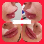مرکز تزریق چربی و لیزر بدن شمس آباد