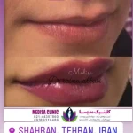 کلینیک پوست مو زیبایی و مرکز لیزر مدیسا