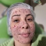 مرکز تخصصی فیشال و ماساژ کیمیا