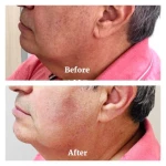  مرکز تخصصی الکترولیز زیبی