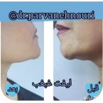  کلینیک زیبایی مرکز لیزر دکترپروانه نوری