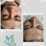  مرکز تخصصی فیشال و ماساژ کیمیا