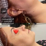 مرکز لیزر و کلینیک زیبایی آیسان