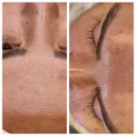  سالن تخصصی پاکسازی پوست سمیه ملکی